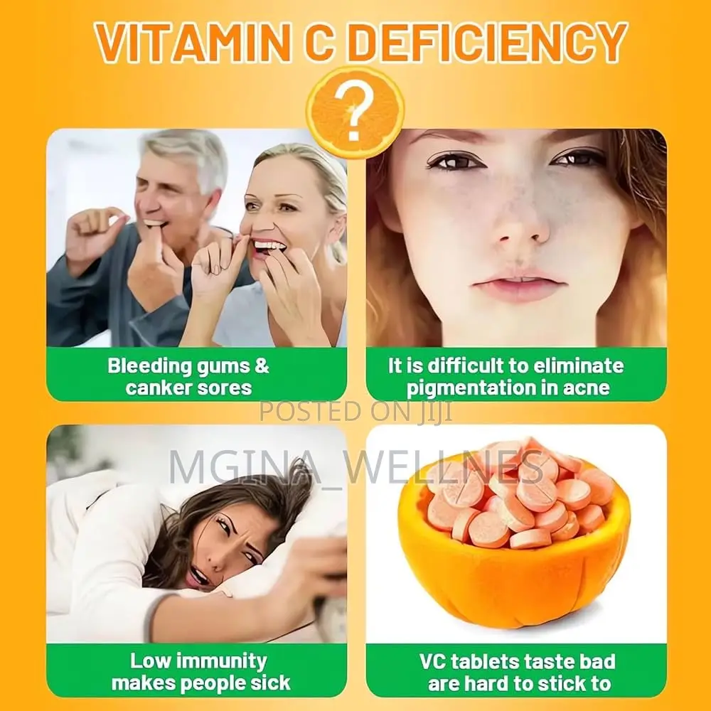 Vitamin C Gummies 250mg, Supports Antioxidant