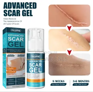 Photo - Jaysuing Advanced Scar Gel for Both New and Old Scars