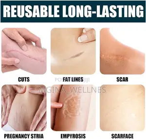 Jaysuing Advanced Scar Gel for Both New and Old Scars