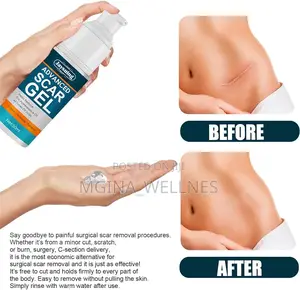 Jaysuing Advanced Scar Gel for Both New and Old Scars
