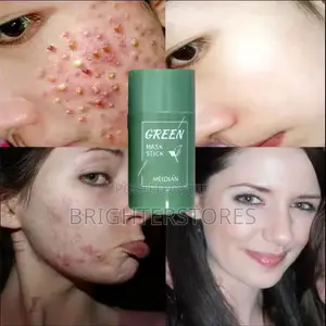 Photo - Green Masks for Acnes