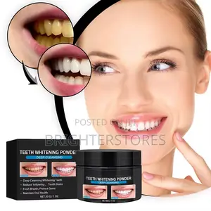 Photo - Teeth Whitening Unisex