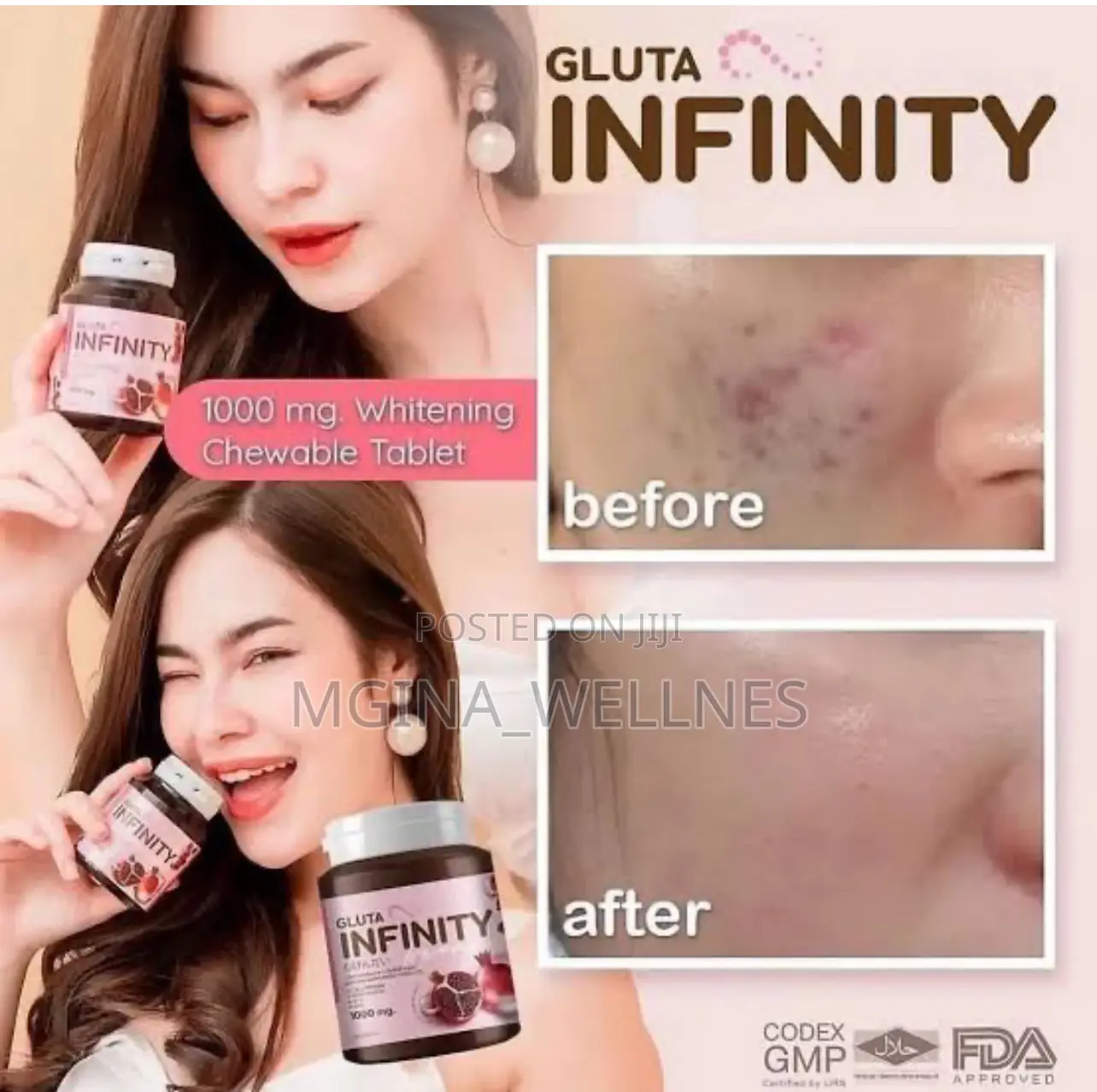 Set of Gluta Infinity Infinity Vitamin C + Zinc Supplement