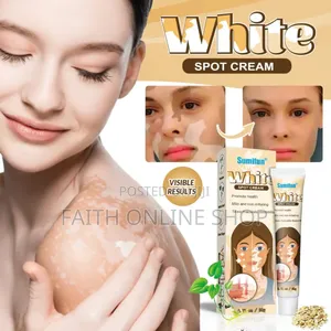 Vitiligo Removal Cream 20gm