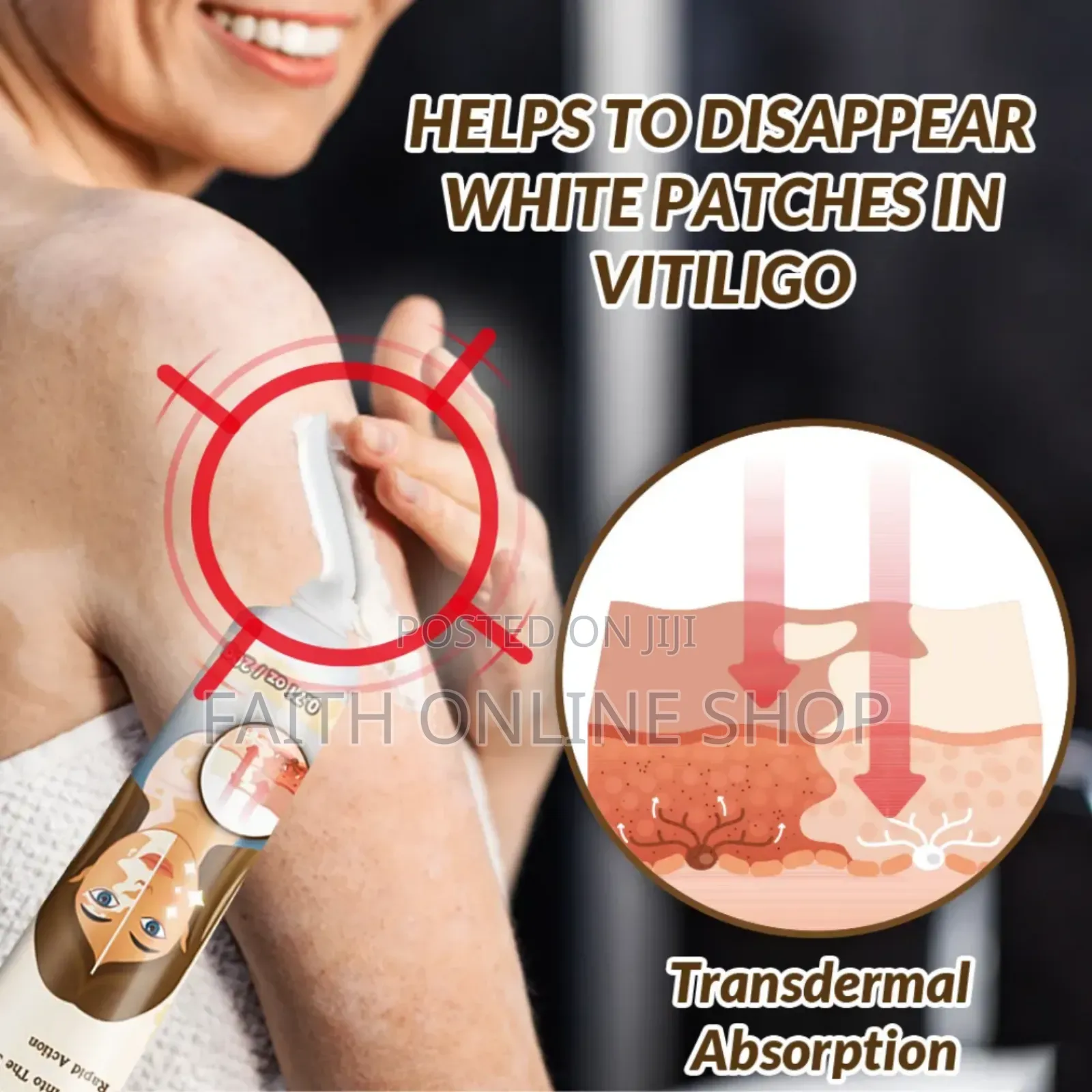 Vitiligo Removal Cream 20gm