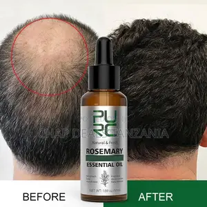 Photo - Rosemary Hair Growth