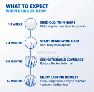 Rogaine Minoxidil Foam 5% Hair Regrowth for Men 1month