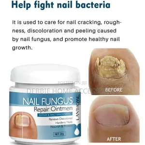 Nail Fungus Repair Ointment