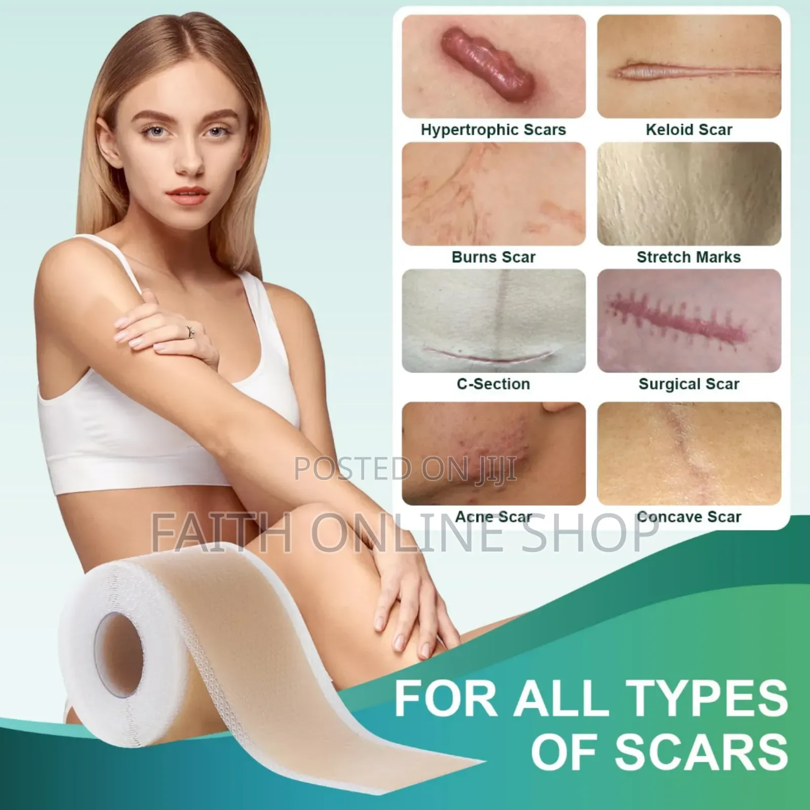 Silicone Scar Sheets Size:* 1.6" X 120" (4cm X 3m)