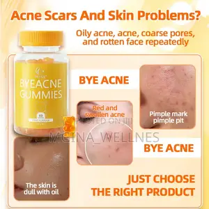 Duozi Bye Acne Gummies