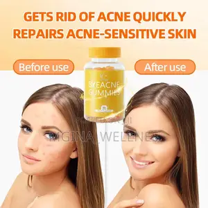 Duozi Bye Acne Gummies
