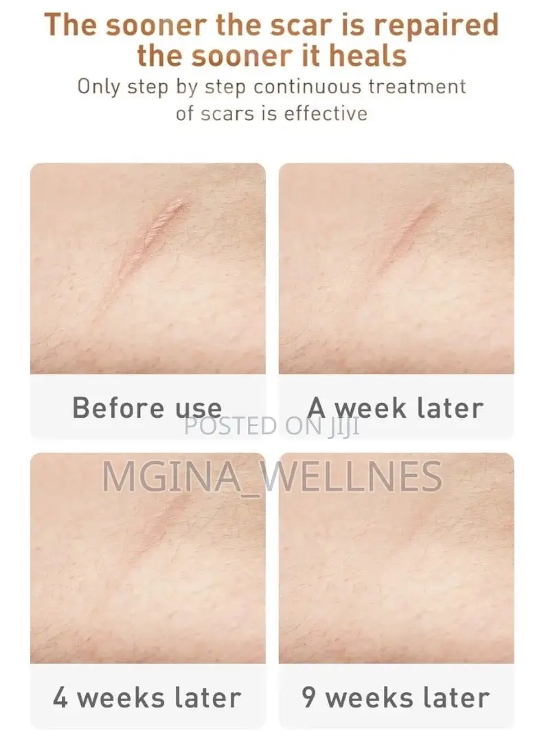 Skin Care Gel Fade Scars Stretch Marks Burns Repair