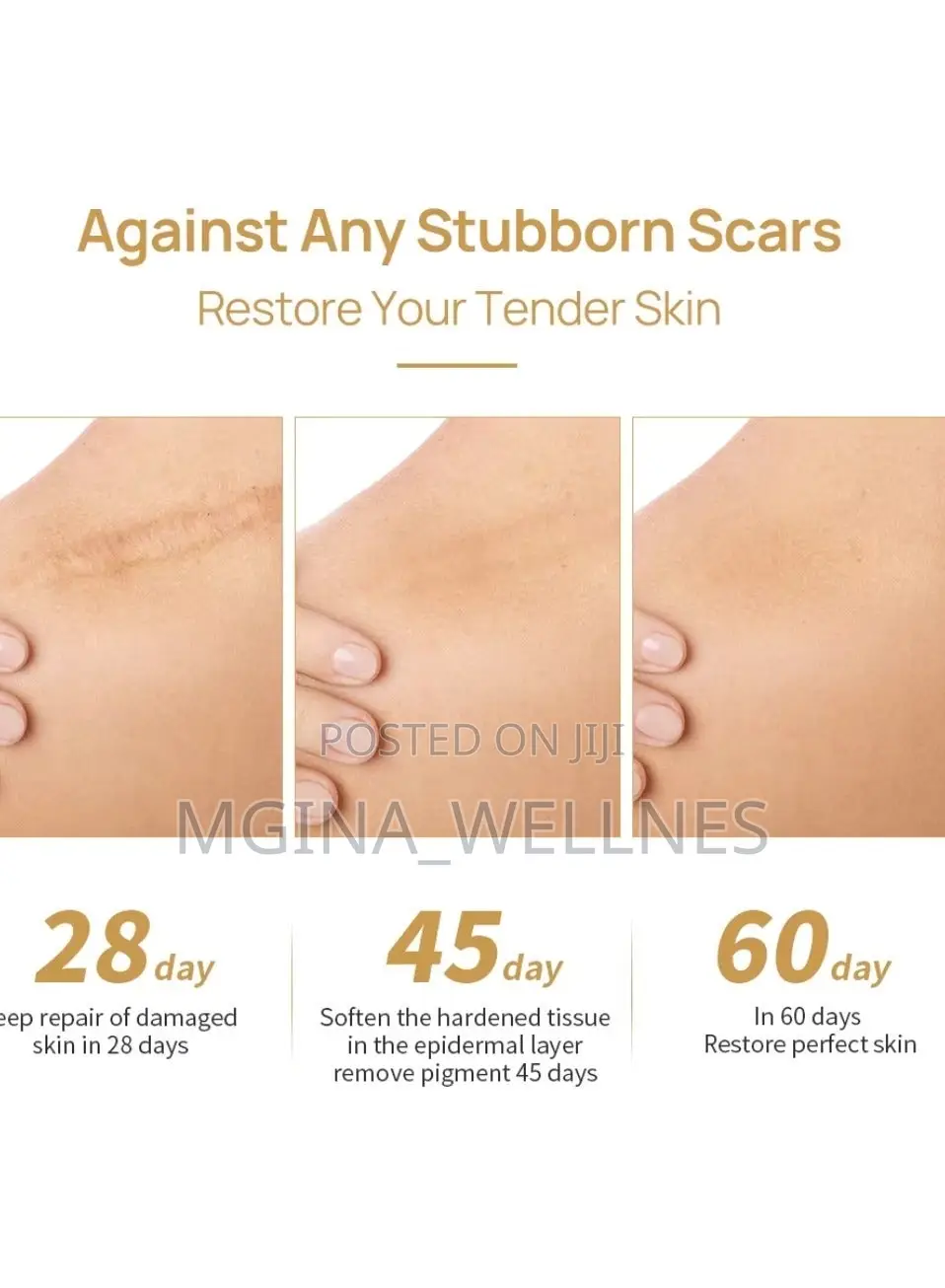 Skin Care Gel Fade Scars Stretch Marks Burns Repair