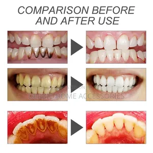 Teeth Whitening Charcoal Powder