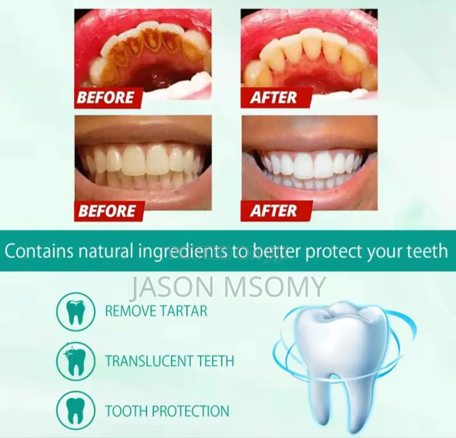 Teeth Whitening Essence