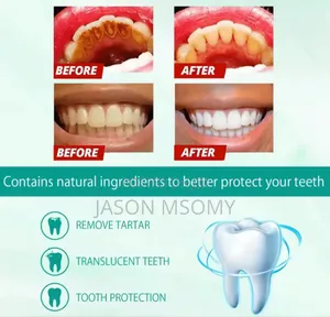 Teeth Whitening Essence