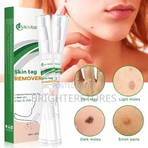 Wart Remover