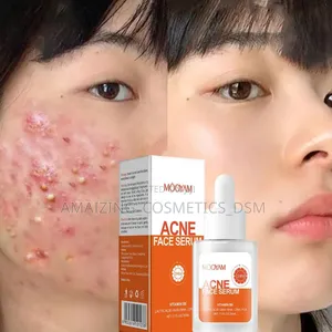 Acne Serum