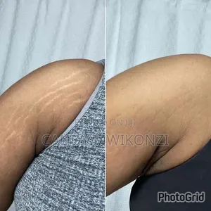 Body Lotion