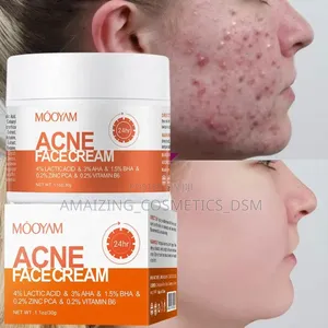 Acne Face Cream