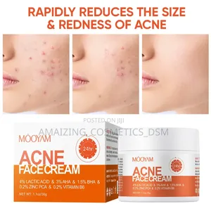 Acne Face Cream