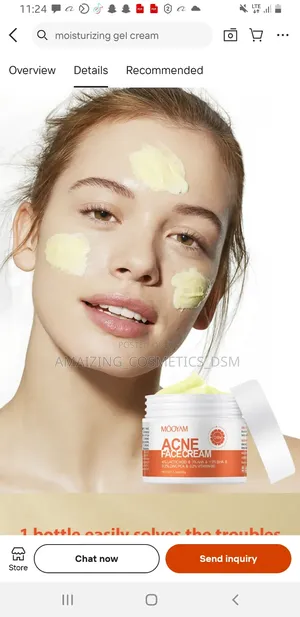 Acne Face Cream