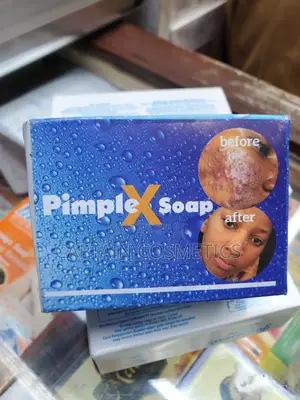 Pimples Soap Ni Sabuni