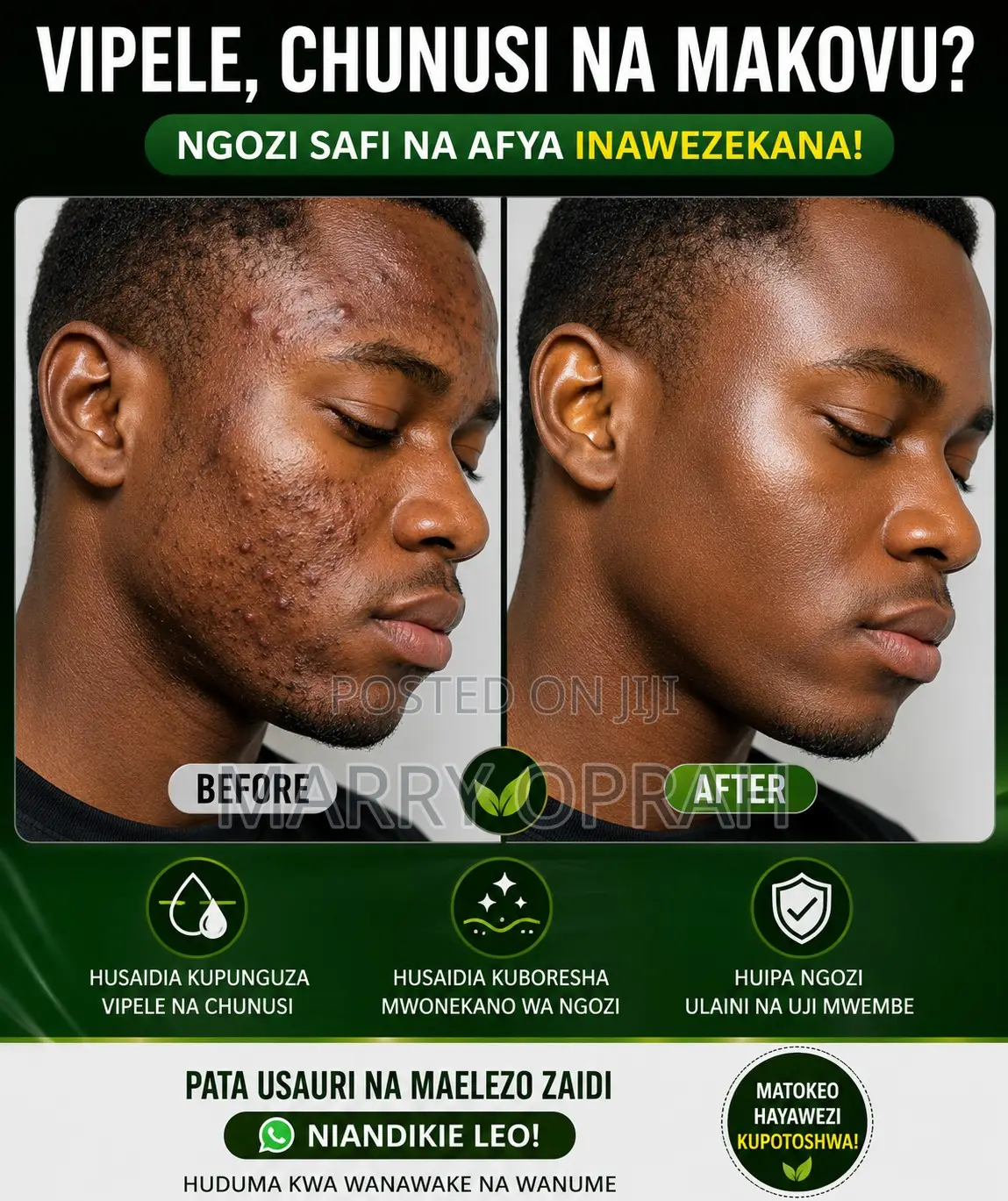Tuna Suluhisho La Vipele After Shave ,Madoa, Chunusi
