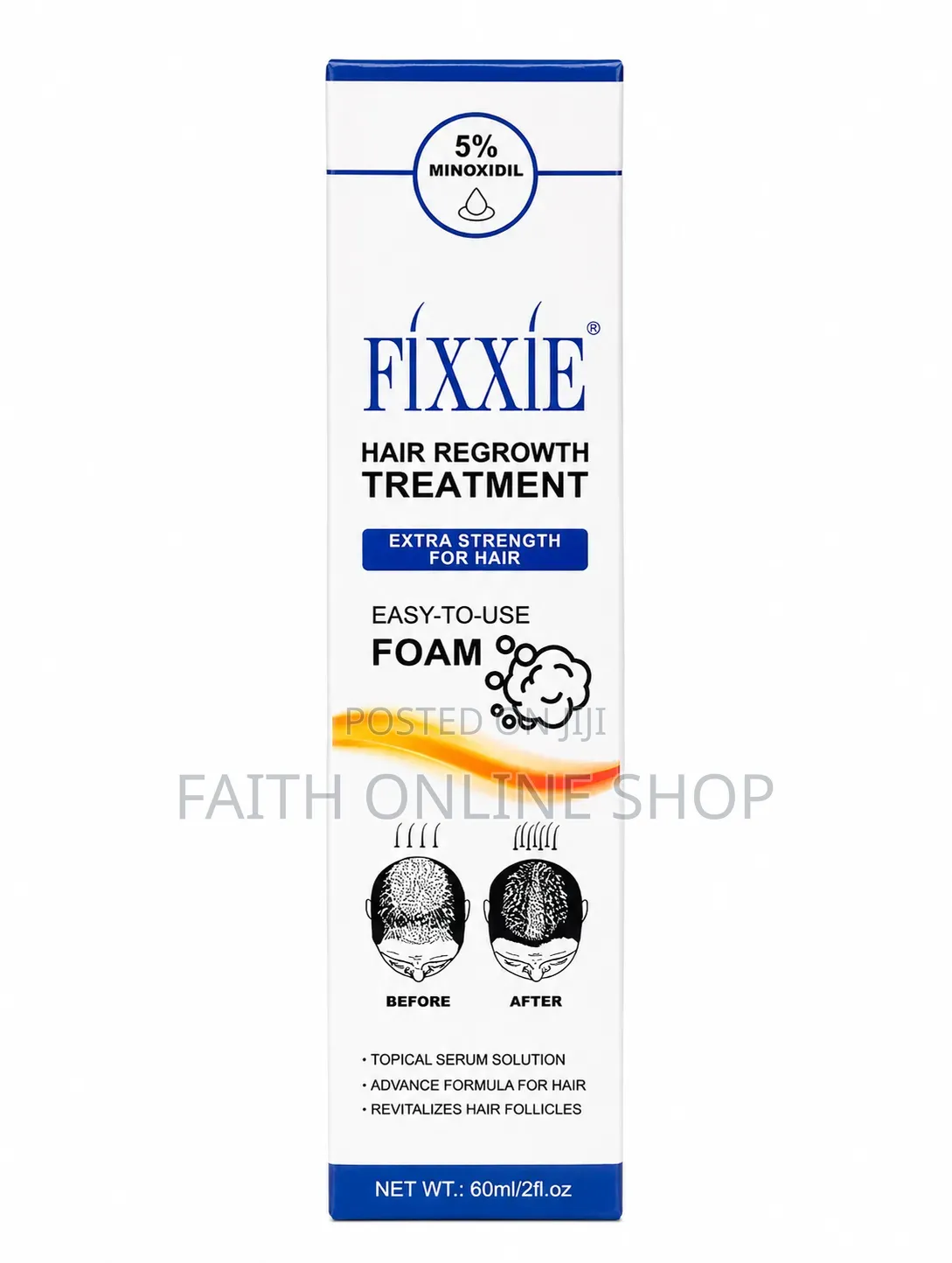 FIXXIE 5% Minoxidil Extra Strength Hair Regrowth Treatment Foam 60ml