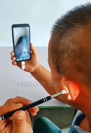 Hd Video Otoscope [Hd Visual Ear Spoon]