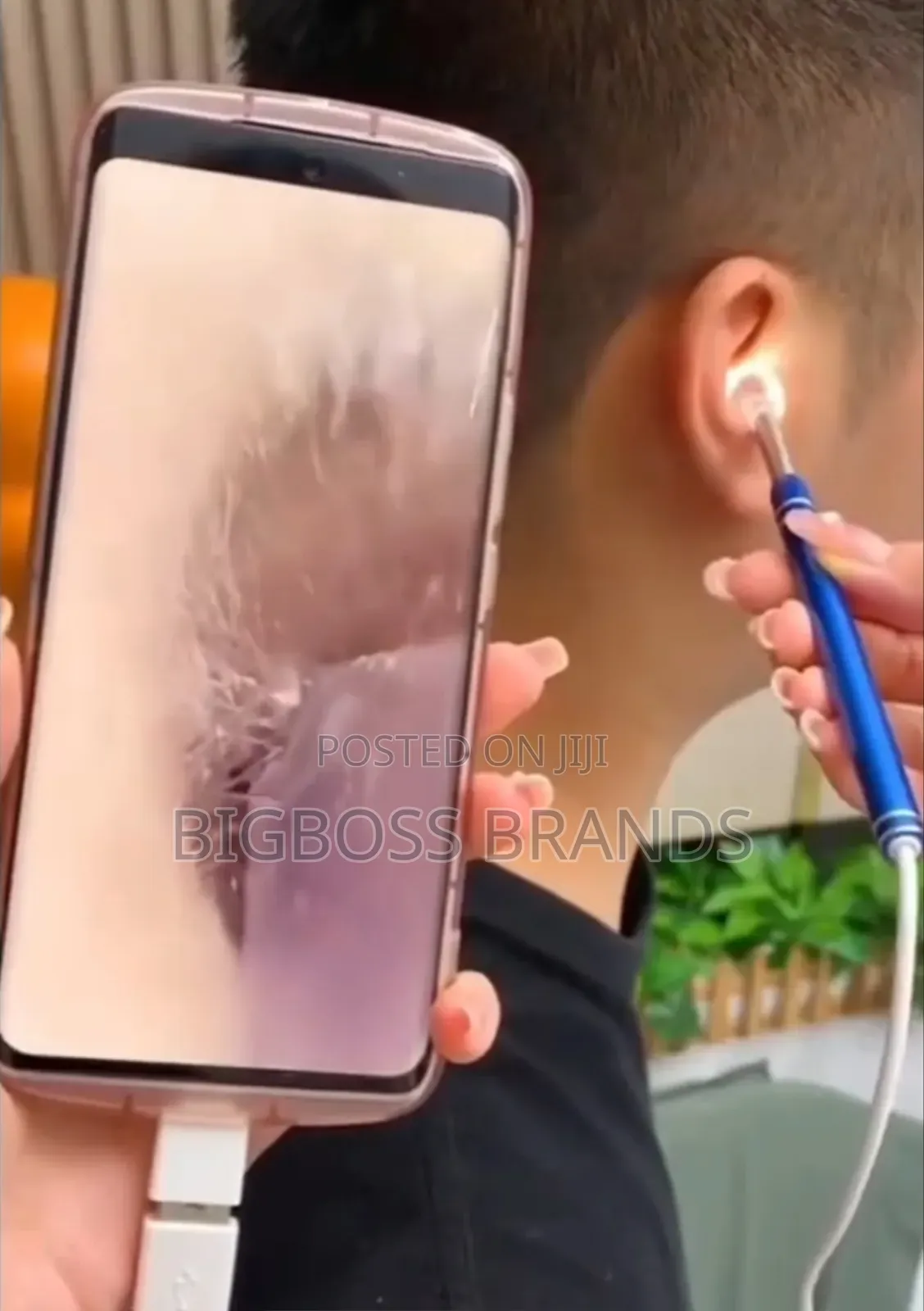Hd Video Otoscope [Hd Visual Ear Spoon]