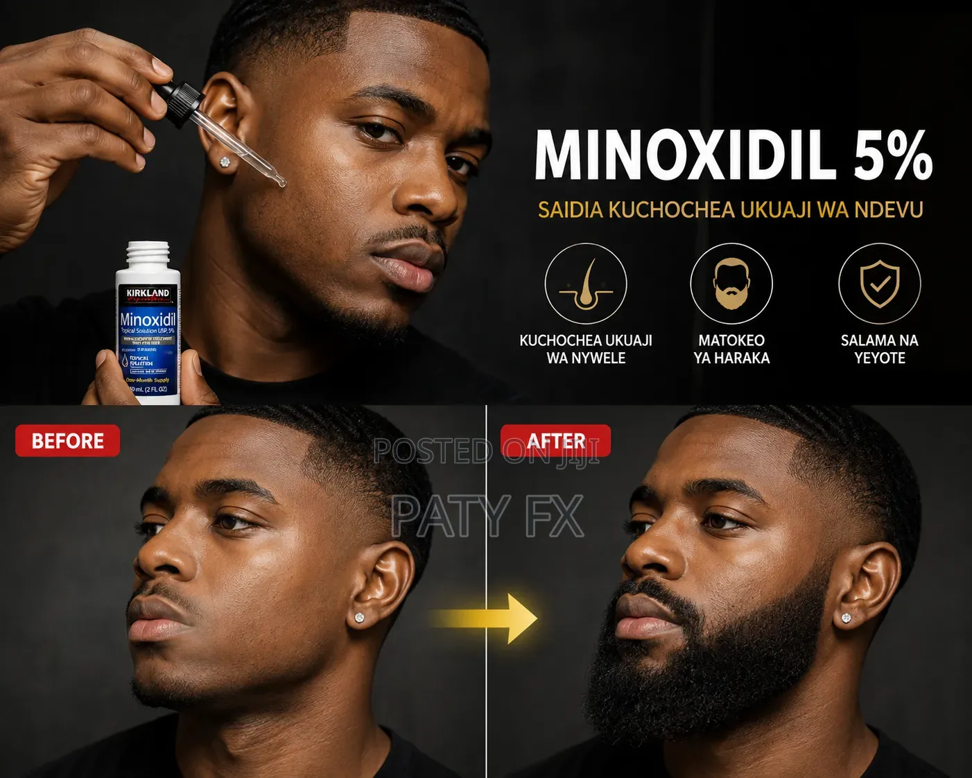 MINOXIDIL 5% (Bei Chee )