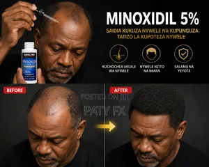 MINOXIDIL 5% (Bei Chee )