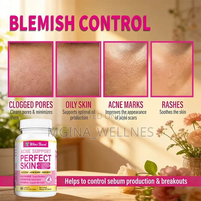 Acne Support Perfect Skin Dietary Supplement Capsules