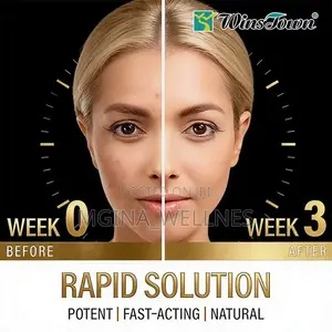 Acne Support Perfect Skin Dietary Supplement Capsules