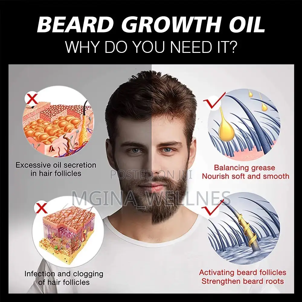 Beard Master Beard Growth Oil (30ml) – Daily Support Formula