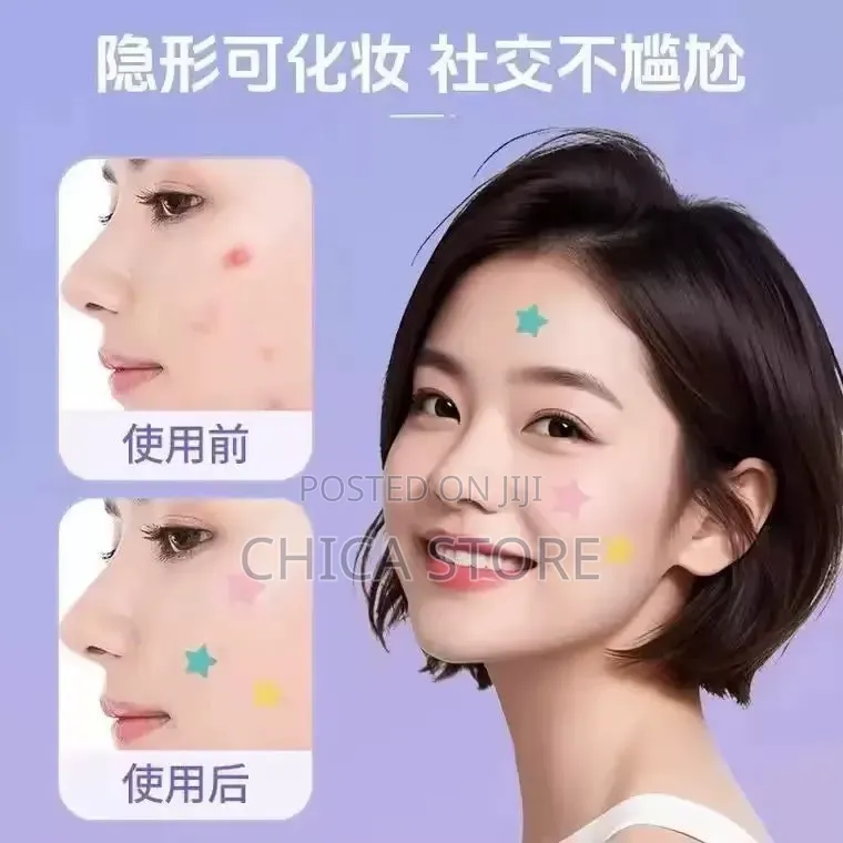Acne Patches ( Vinyota)