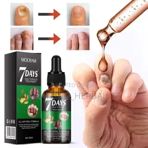 Nail Fungus Treatment