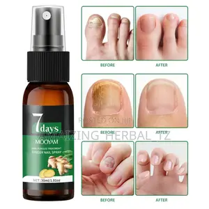 Nail Fungus Treatment
